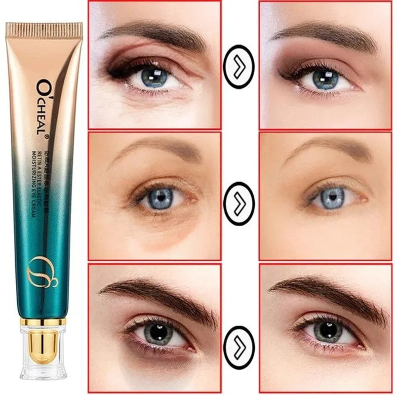 New Anti-Wrinkle Eye Cream Eye Serum Fades Crow's Feet Remove Eye Bags Dark Circles Puffiness Anti-Aging Firmness Eye Care